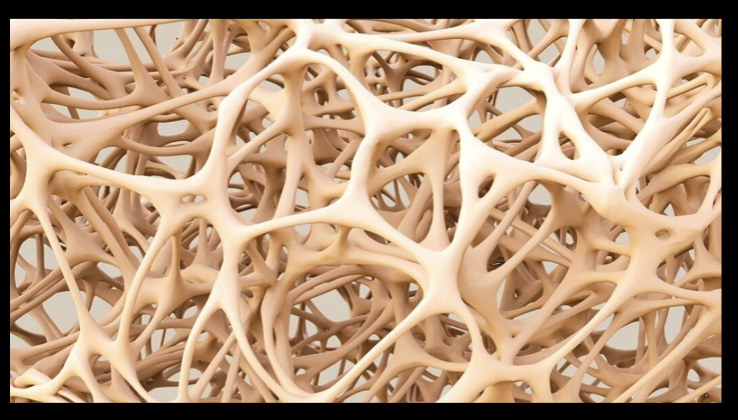 A close up image inside a healthy bone below reveals a dense matrix style structure. 
